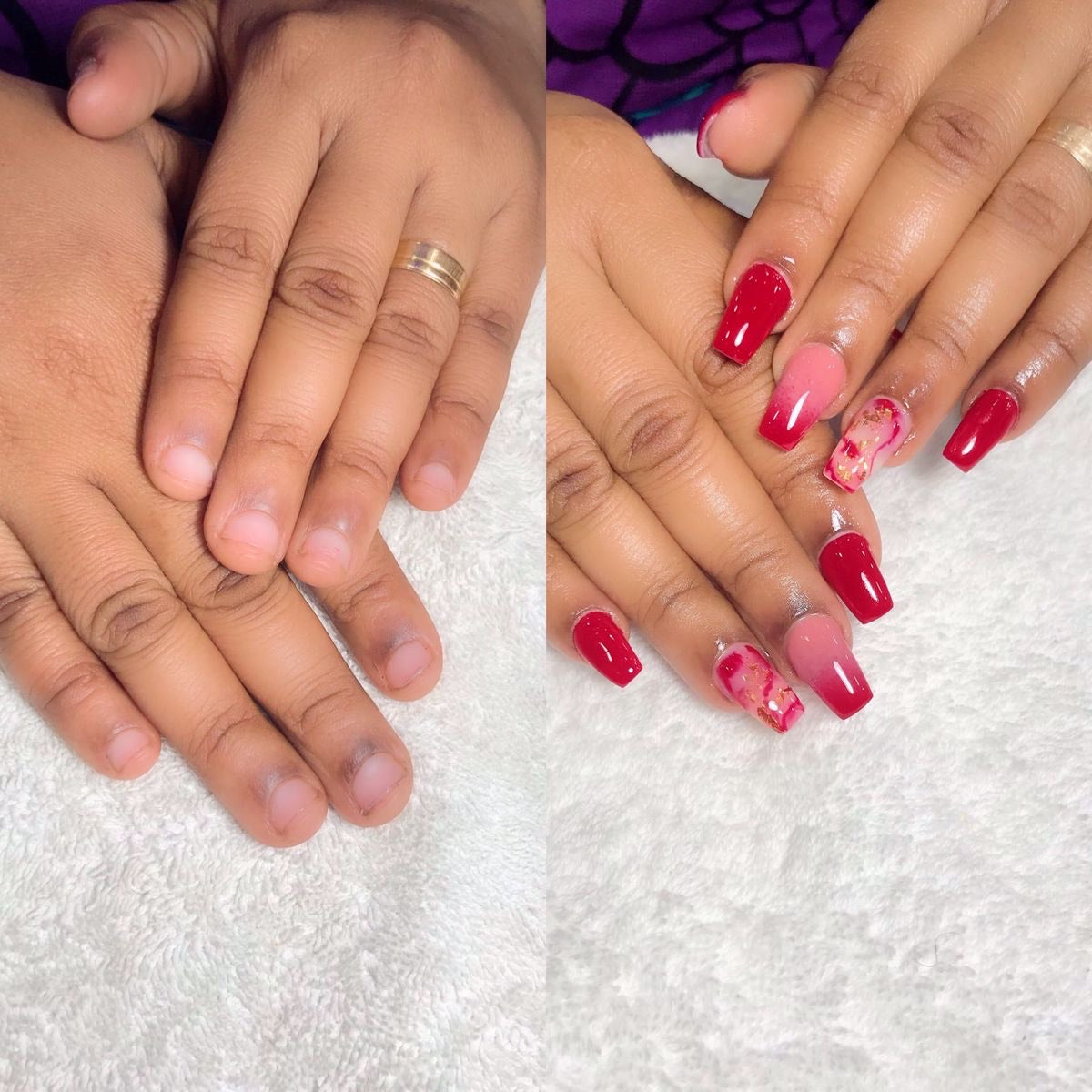 Antes y después 2