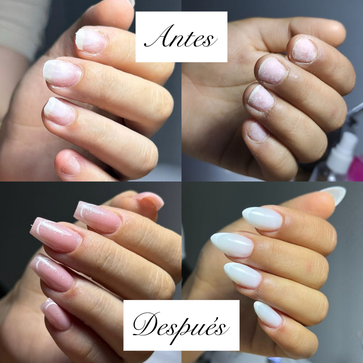 Antes y después 1